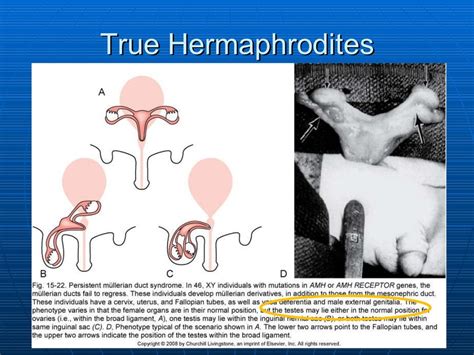 Hermaphrodite